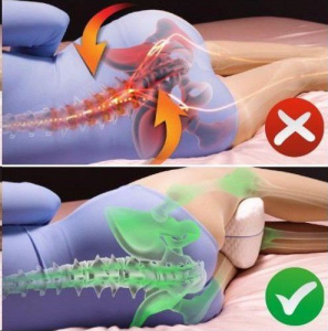 Dreamolino Leg Pillow Ergonómikus térd-és lábtámasz párna (M21615 / M31544)
