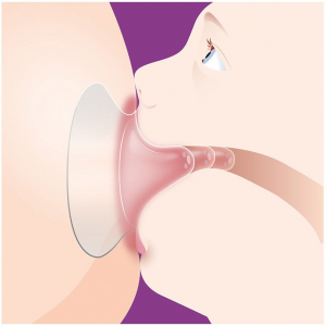 Philips AVENT S mellbimb&oacute;v&eacute;dő, 2 db mellbimb&oacute;v&eacute;dő extra l&aacute;gy szilikonb&oacute;l